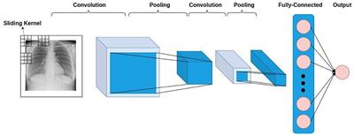 CCTCOVID: COVID-19 detection from chest X-ray images using Compact Convolutional Transformers